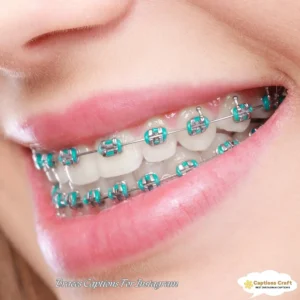 137+ Cute Braces Captions For Instagram and Quotes To Embrace Every Sparkling Moment